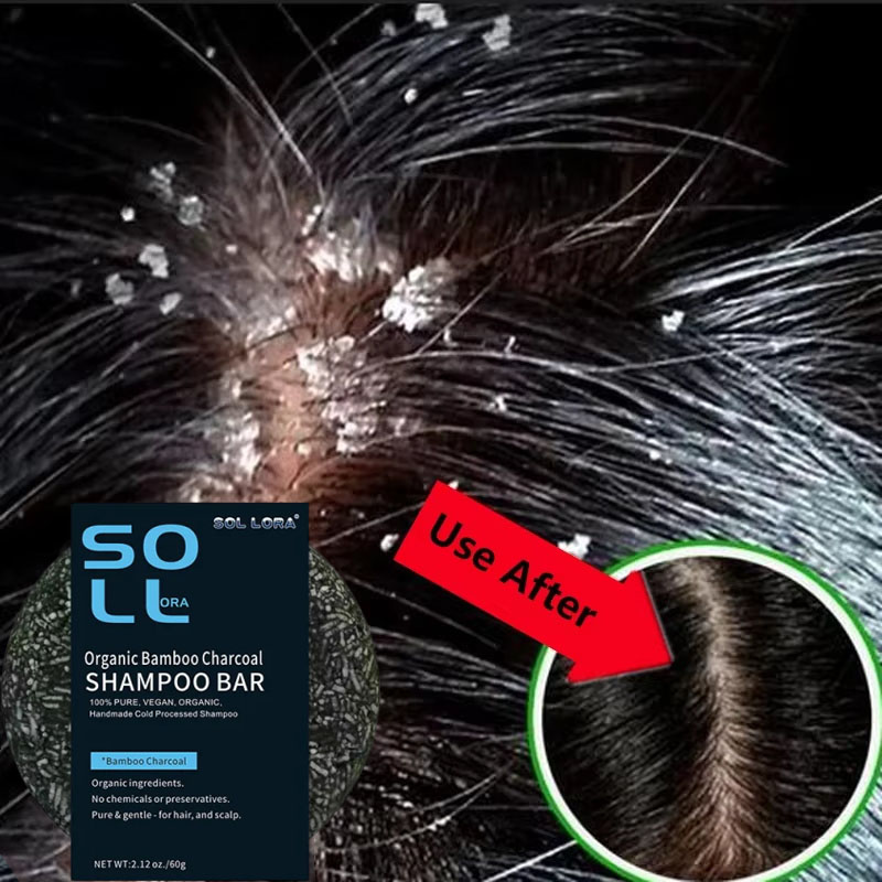 Fast Anti Dandruff Hair Treatm - Castor Oil Soap review and price