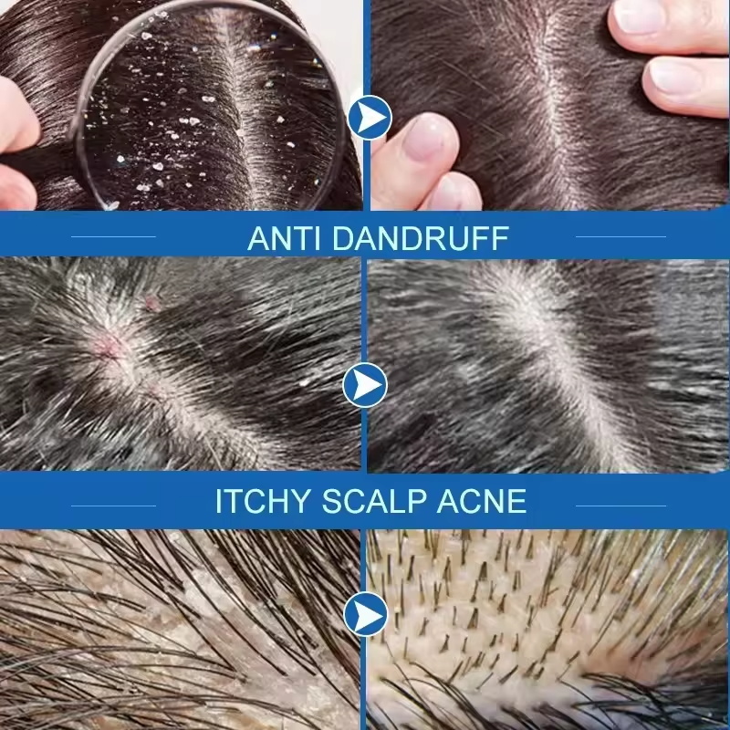 Fast Anti Dandruff Hair Treatm - Castor Oil Soap review and price