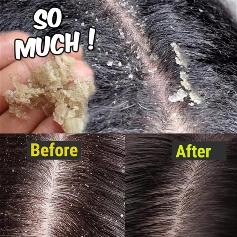 Fast Anti Dandruff Hair Treatm - Castor Oil Soap review and price